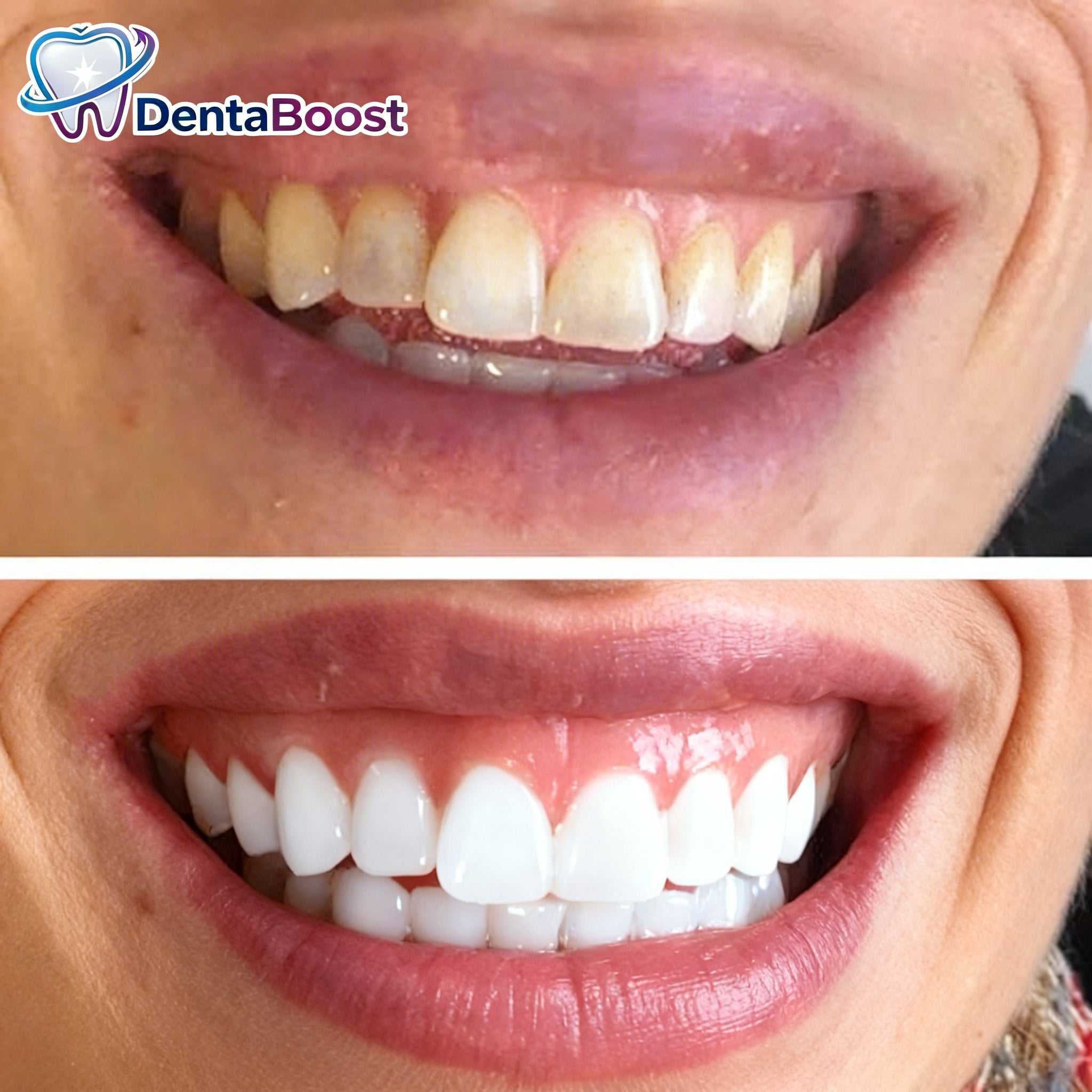 DentaBoost LumiStrips™ — Bandes Blanchissantes PAP+ Sans Peroxyde